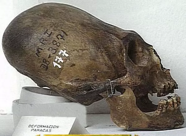 Arqueologia Marinha Tecnológica, Rota Comercial Antiga Marítima, Cidades Subaquáticas Antigas, Tesouros Náuticos, Naufrágios Históricos Submersos, Culturas Costeiras Ancestrais, Pesquisa Arqueológica Submarina, Mistérios da Idade do Bronze, Cápsulas do Tempo Aquáticas, Civilizações Aquáticas Esquecidas, Mitologia Submersa, Descobertas Arqueológicas Subaquáticas, Nômades da Idade da Pedra, Serpentes Guardiãs na Arqueologia, Debates sobre Ruínas Submersas, Estruturas Antigas em Zonas Costeiras, Exploração de Cenotes Maias, Relíquias da Roma Antiga no Mar, Riqueza Arqueológica do Mar Báltico, Civilizações Afundadas na História Marítima